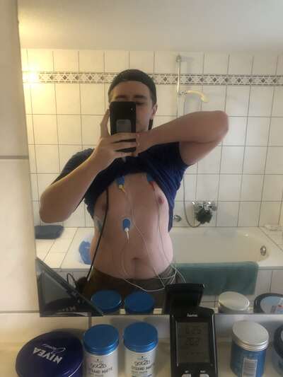 Max 2019 mit Langzeit-EKG-Elektroden am Oberkörper